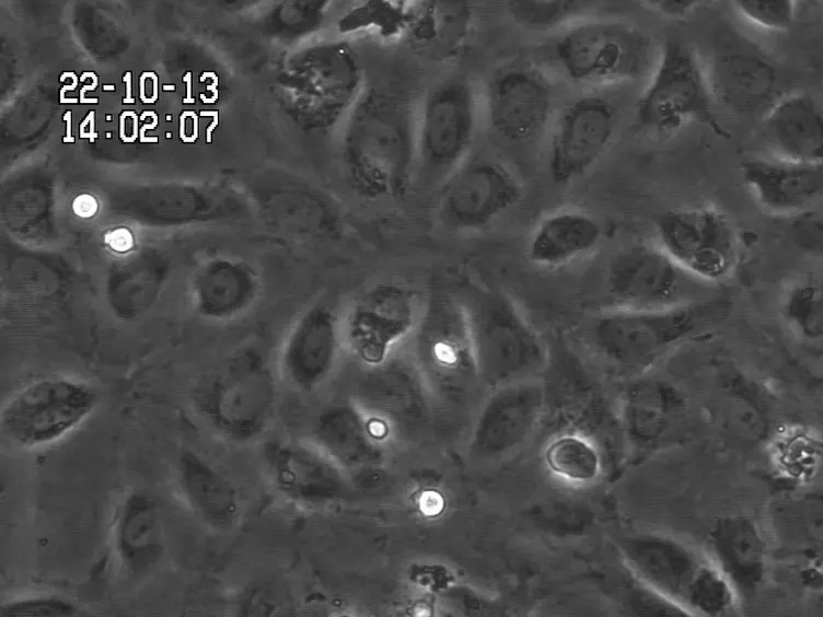 Analyzing the Effects of Stromal Cells on the Recruitment of Leukocytes from Flow
