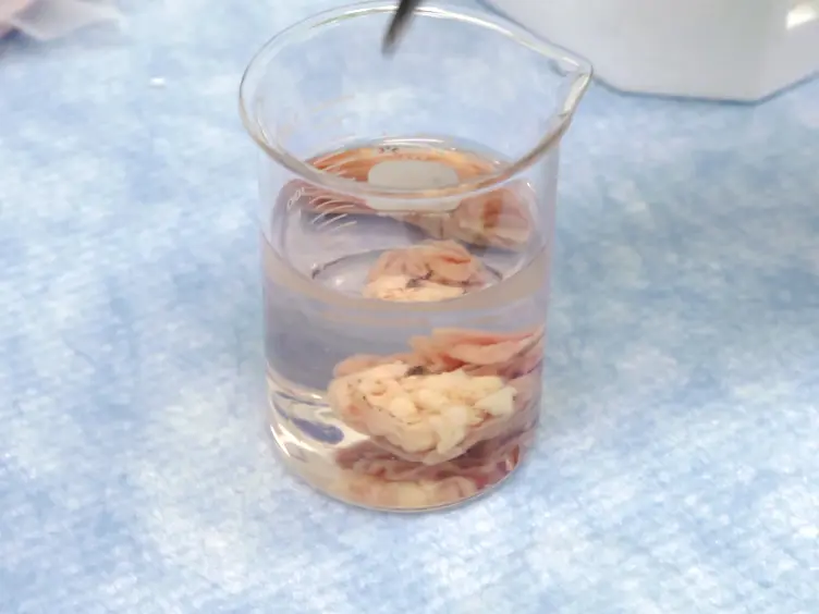 Establishment of Human Epithelial Enteroids and Colonoids from Whole Tissue and Biopsy