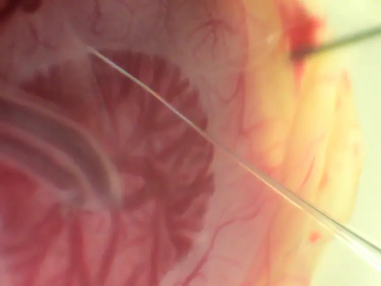 Contrast Imaging in Mouse Embryos Using High-frequency Ultrasound