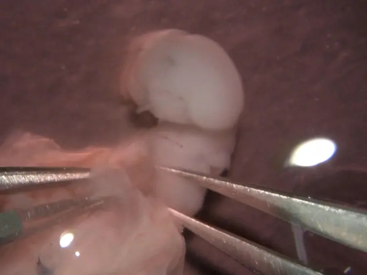 <em>Ex Utero</em> Electroporation and Organotypic Slice Culture of Mouse Hippocampal Tissue