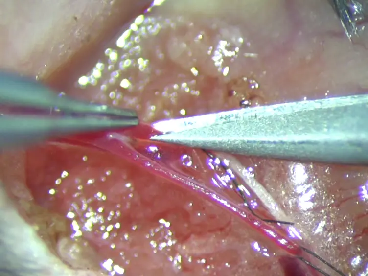 A Murine Model of Arterial Restenosis: Technical Aspects of Femoral Wire Injury