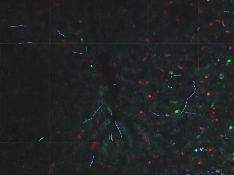 Long Term Intravital Multiphoton Microscopy Imaging of Immune Cells in Healthy and Diseased Liver Using CXCR6.Gfp Reporter Mice