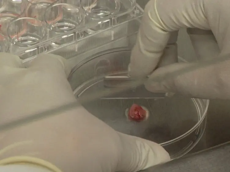 Primary Tumor and MEF Cell Isolation to Study Lung Metastasis