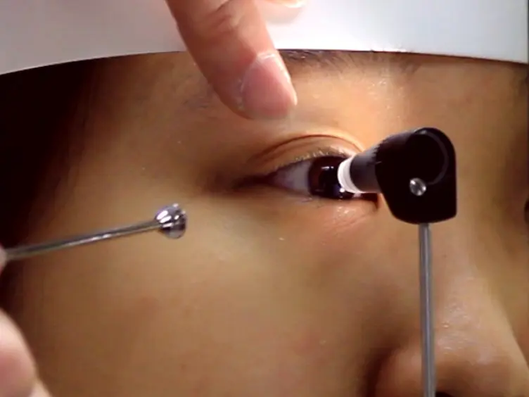 Trabecular Meshwork Response to Pressure Elevation in the Living Human Eye