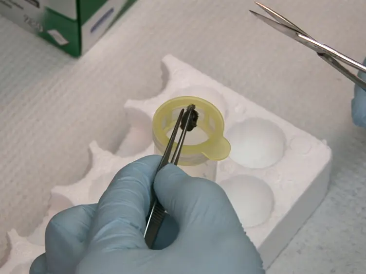 Evaluation of Tumor-infiltrating Leukocyte Subsets in a Subcutaneous Tumor Model