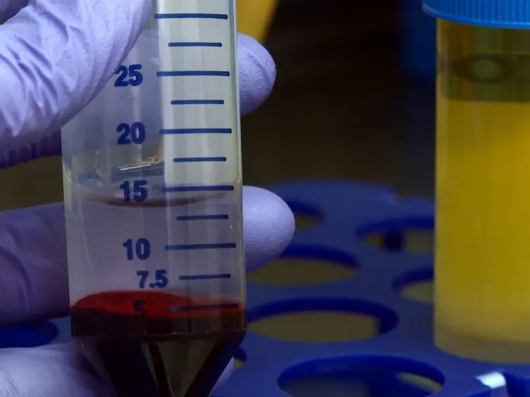 Simplified Human Neutrophil Extracellular Traps (NETs) Isolation and Handling