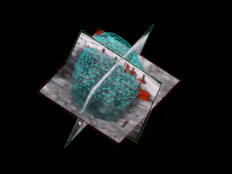 High-frequency Ultrasound Imaging of Mouse Cervical Lymph Nodes