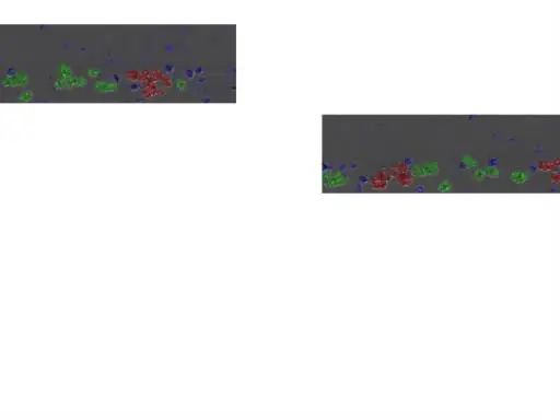 Controlled Microfluidic Environment for Dynamic Investigation of Red Blood Cell Aggregation