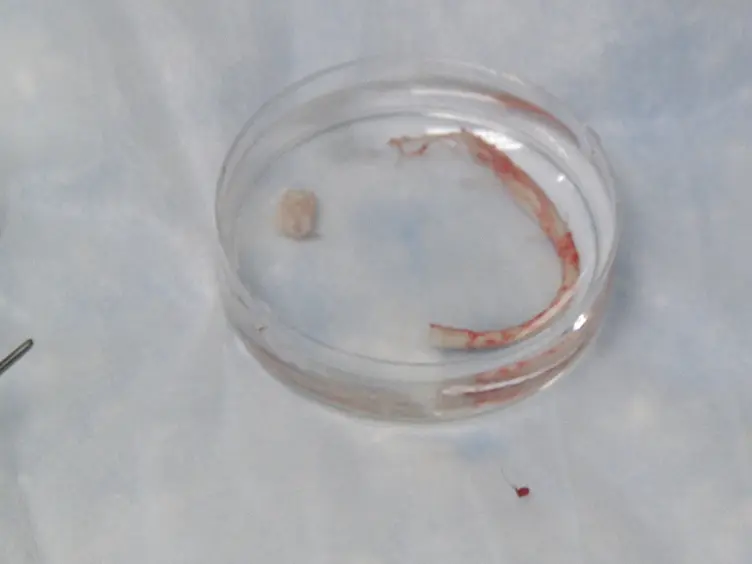 Isolation of Neural Stem/Progenitor Cells from the Periventricular Region of the Adult Rat and Human Spinal Cord