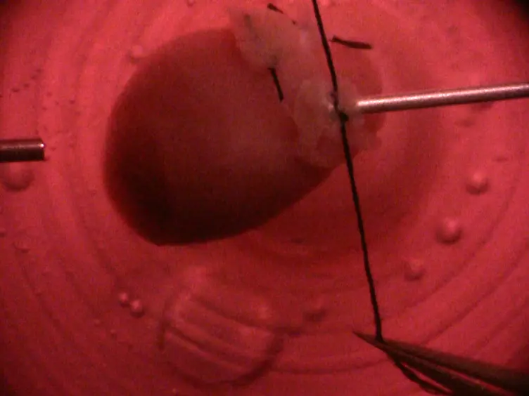 Culturing Mouse Cardiac Valves in the Miniature Tissue Culture System