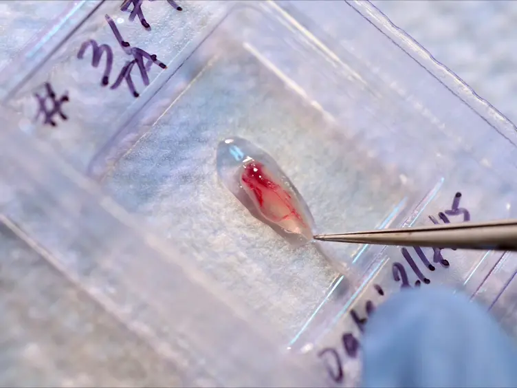 Do's and Don'ts in the Preparation of Muscle Cryosections for Histological Analysis