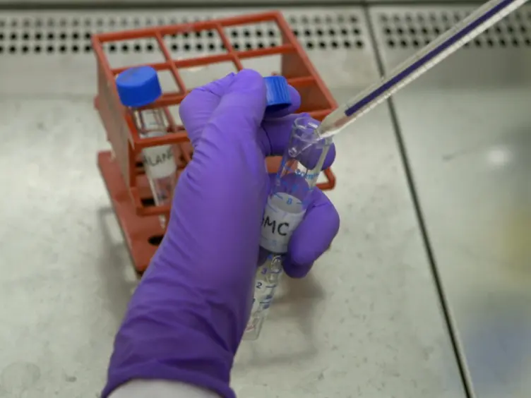 Generation of Recombinant Human IgG Monoclonal Antibodies from Immortalized Sorted B Cells