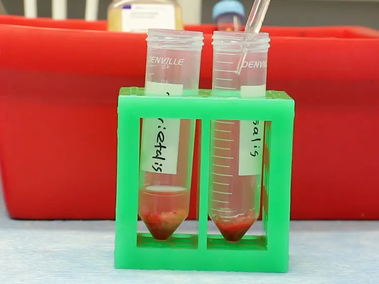 Isolation of Leukocytes from the Human Maternal-fetal Interface
