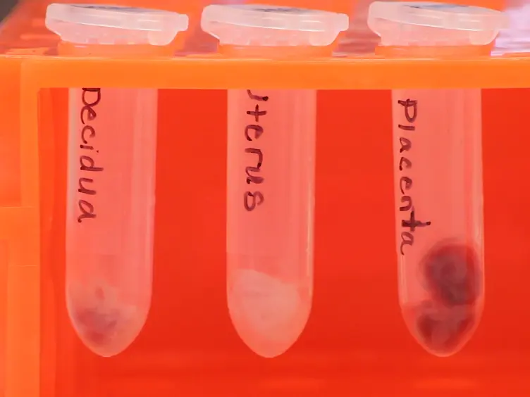 Isolation of Leukocytes from the Murine Tissues at the Maternal-Fetal Interface