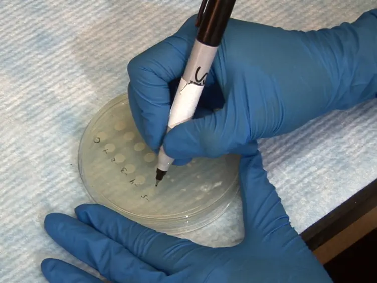 Establishment and Characterization of UTI and CAUTI in a Mouse Model
