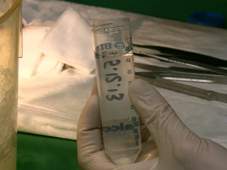 Heterotopic Cervical Heart Transplantation in Mice