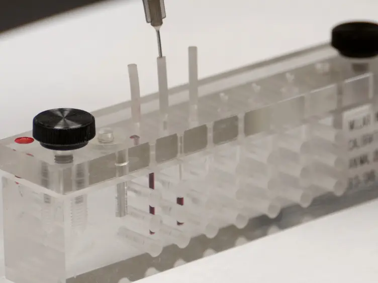 Cardiac Pressure-Volume Loop Analysis Using Conductance Catheters in Mice