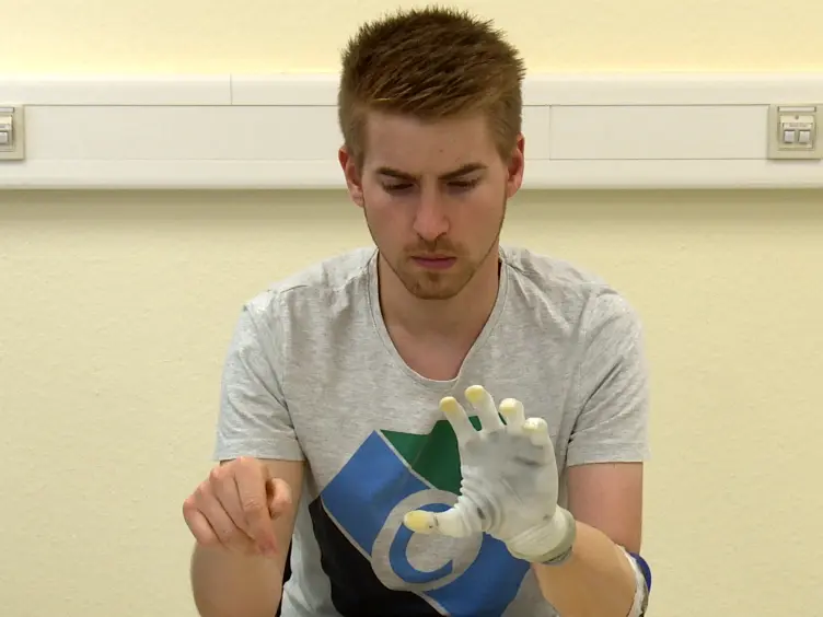 A Structured Rehabilitation Protocol for Improved Multifunctional Prosthetic Control: A Case Study