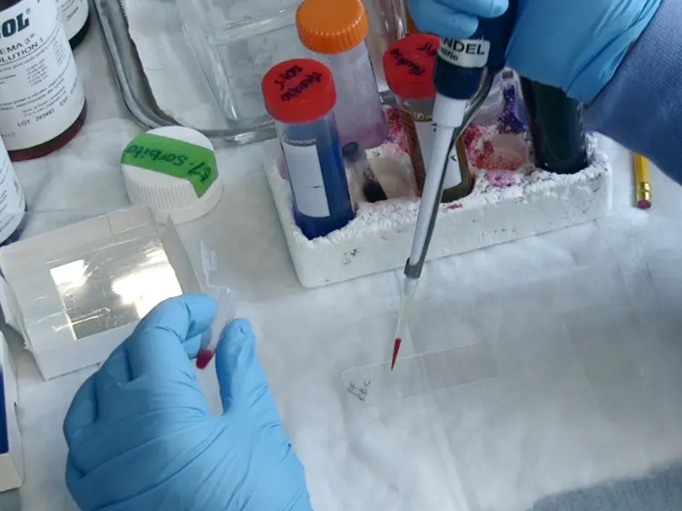 An <em>In Vitro</em> Model for Measuring Immune Responses to Malaria in the Context of HIV Co-infection