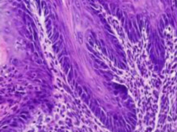 Surgical Models of Gastroesophageal Reflux with Mice