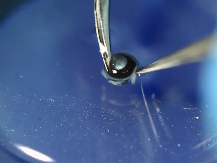 Limbal Approach-Subretinal Injection of Viral Vectors for Gene Therapy in Mice Retinal Pigment Epithelium