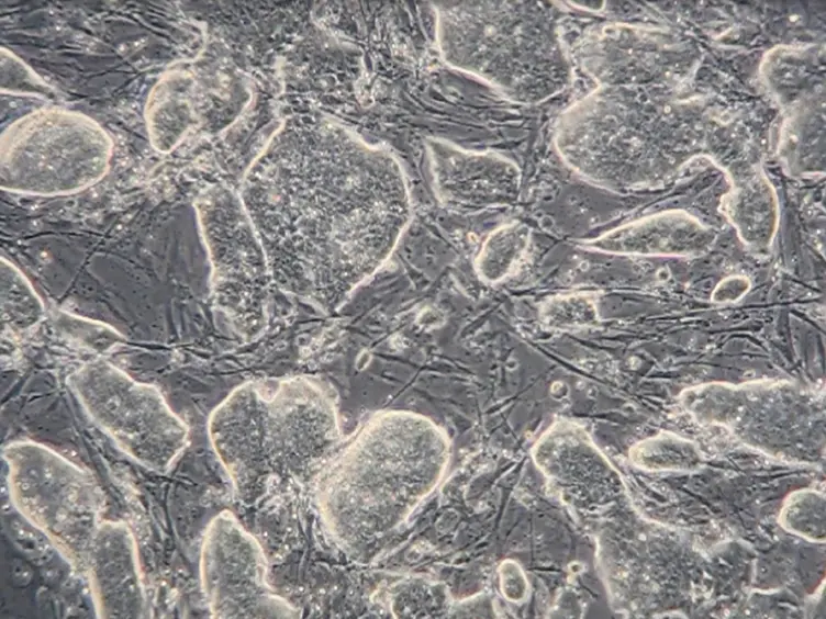 Forward Genetic Approach to Uncover Stress Resistance Genes in Mice — A High-throughput Screen in ES Cells
