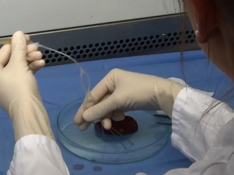 Protocol for Isolation of Primary Human Hepatocytes and Corresponding Major Populations of Non-parenchymal Liver Cells