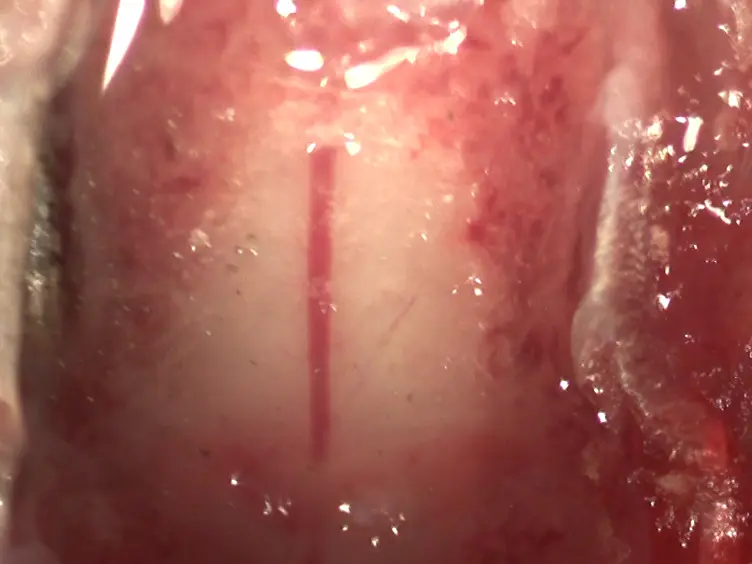 Photothrombosis-induced Focal Ischemia as a Model of Spinal Cord Injury in Mice