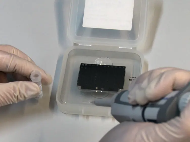 Identification of Rare Bacterial Pathogens by 16S rRNA Gene Sequencing and MALDI-TOF MS