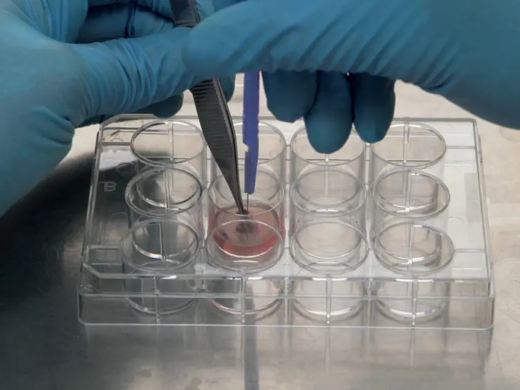 An Optimized Method for Isolating and Expanding Invariant Natural Killer T Cells from Mouse Spleen