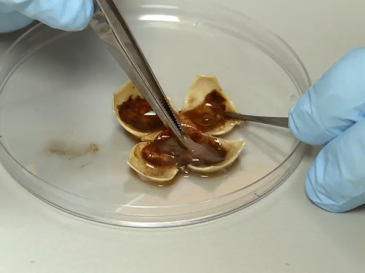 Enrichment of Bruch's Membrane from Human Donor Eyes