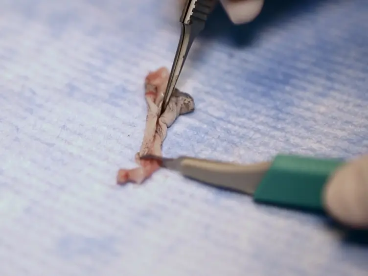 Murine Dermal Fibroblast Isolation by FACS