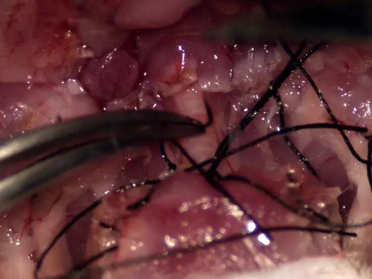 A Novel Microsurgical Model for Heterotopic, En Bloc Chest Wall, Thymus, and Heart Transplantation in Mice