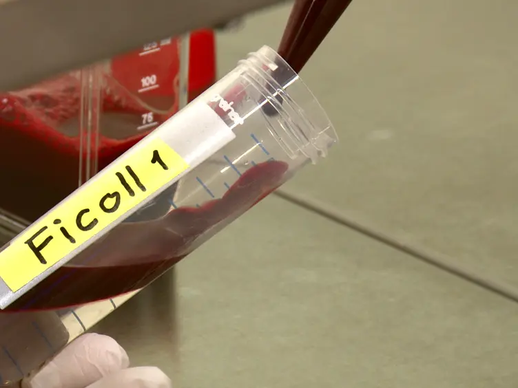 Isolation and <em>Ex Vivo</em> Culture of Vδ1<sup>+</sup>CD4<sup>+</sup>γδ T Cells, an Extrathymic αβT-cell Progenitor