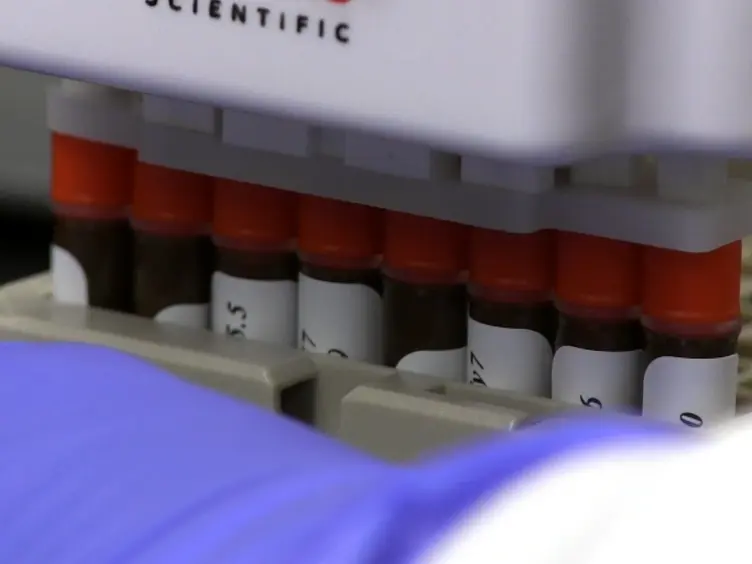 A Semi-automated Approach to Preparing Antibody Cocktails for Immunophenotypic Analysis of Human Peripheral Blood
