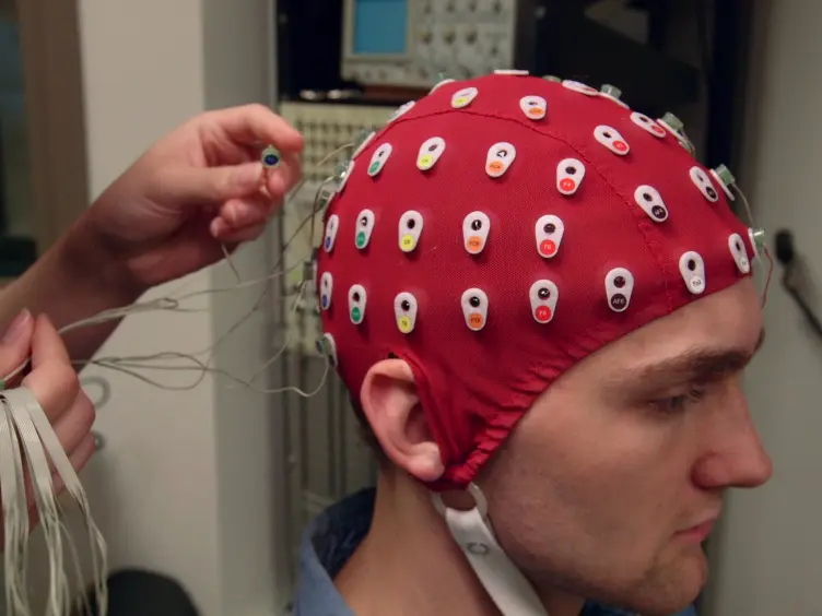 Somatosensory Event-related Potentials from Orofacial Skin Stretch Stimulation