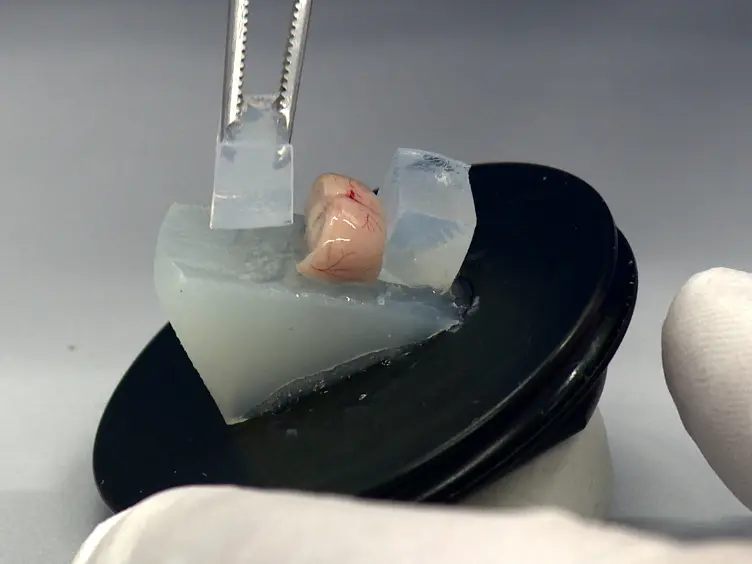 <em>Ex Vivo</em> Optogenetic Dissection of Fear Circuits in Brain Slices