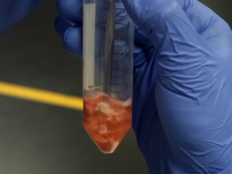 Isolation of Infiltrating Leukocytes from Mouse Skin Using Enzymatic Digest and Gradient Separation