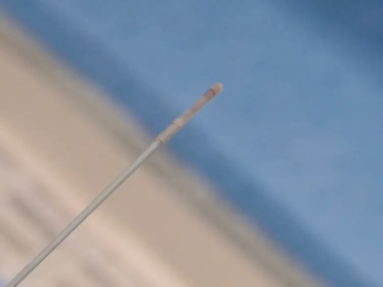 A Rat Carotid Balloon Injury Model to Test Anti-vascular Remodeling Therapeutics
