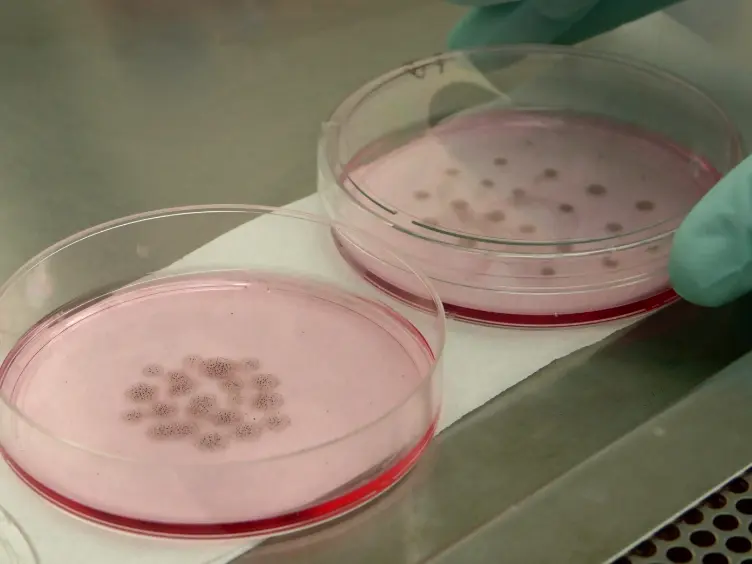 Feeder-free Derivation of Melanocytes from Human Pluripotent Stem Cells