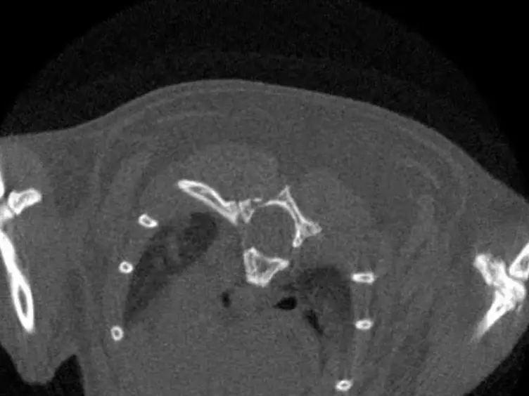 Using Micro-computed Tomography for the Assessment of Tumor Development and Follow-up of Response to Treatment in a Mouse Model of Lung Cancer