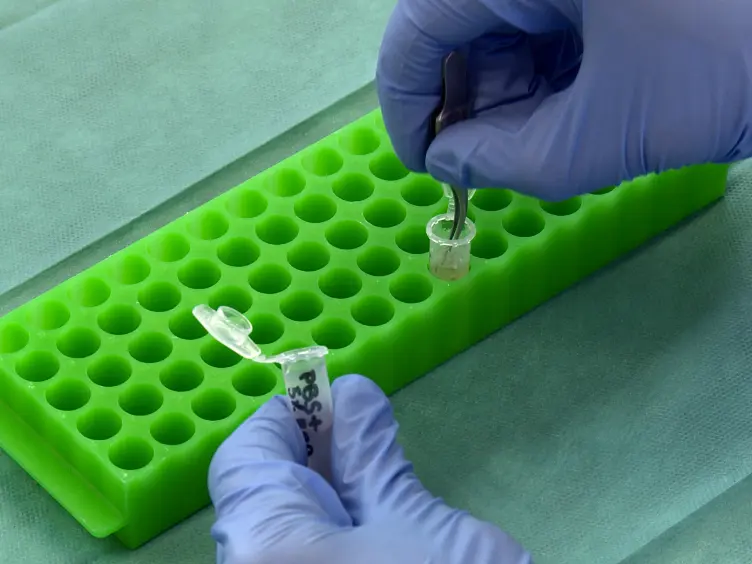 Using a Laminating Technique to Perform Confocal Microscopy of the Human Sclera