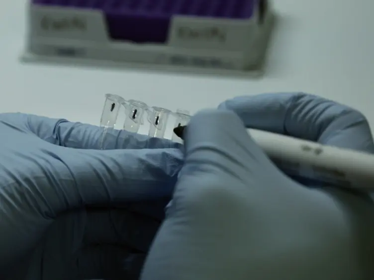 Efficient Nucleic Acid Extraction and 16S rRNA Gene Sequencing for Bacterial Community Characterization