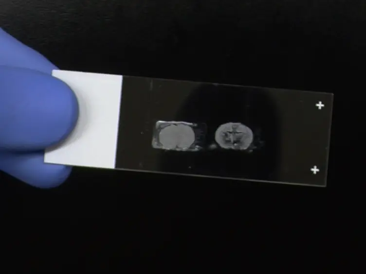 Combining Double Fluorescence <em>In Situ</em> Hybridization with Immunolabelling for Detection of the Expression of Three Genes in Mouse Brain Sections