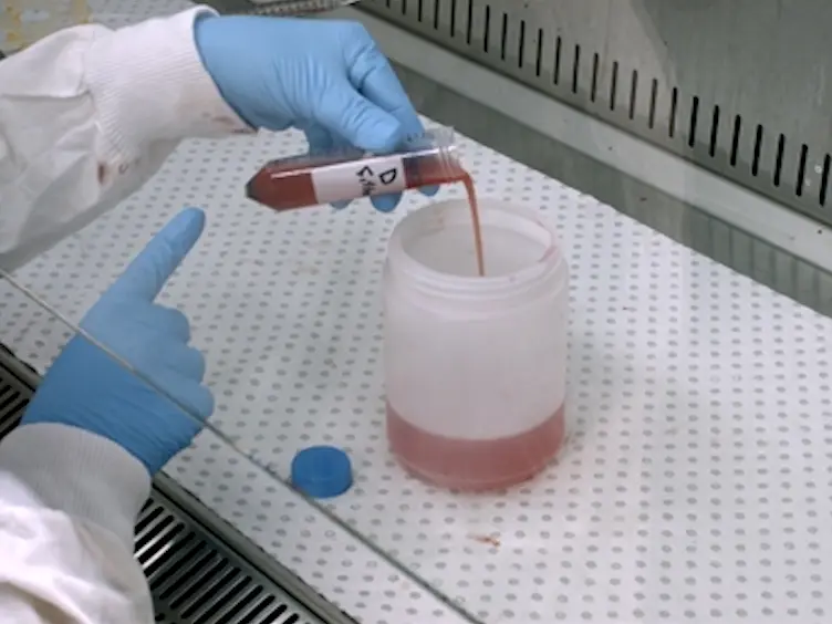 Isolation and Expansion of Mesenchymal Stem/Stromal Cells Derived from Human Placenta Tissue