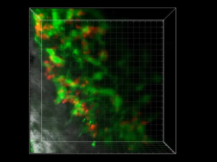 Femur Window Chamber Model for <em>In Vivo</em> Cell Tracking in the Murine Bone Marrow