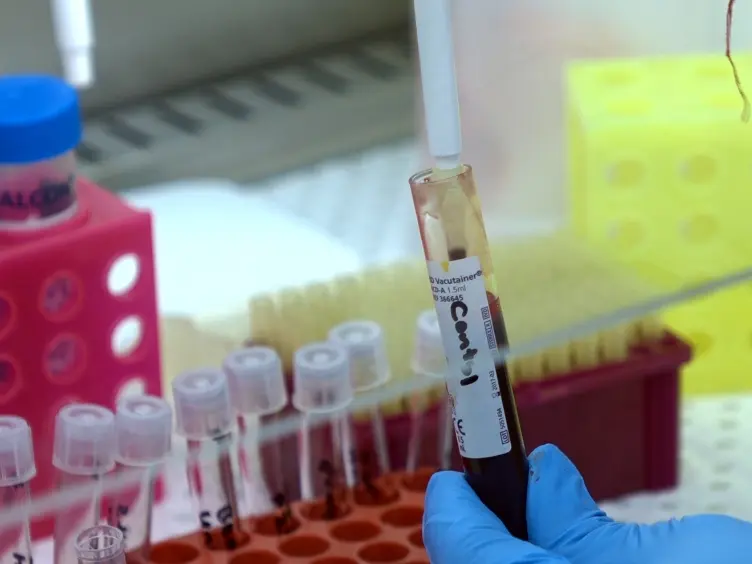 A Simple Flow Cytometric Method to Measure Glucose Uptake and Glucose Transporter Expression for Monocyte Subpopulations in Whole Blood