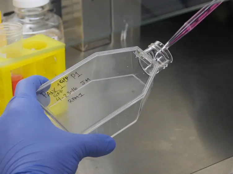 Fluorescent Orthotopic Mouse Model of Pancreatic Cancer