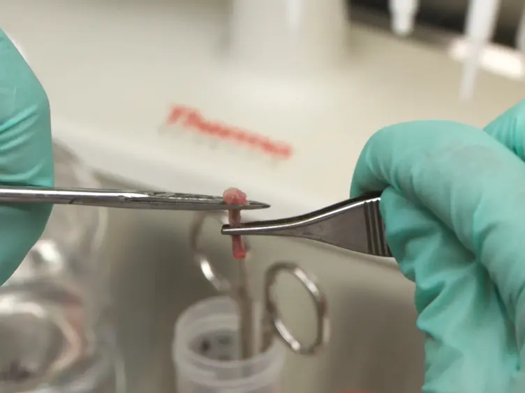 Competitive Transplants to Evaluate Hematopoietic Stem Cell Fitness