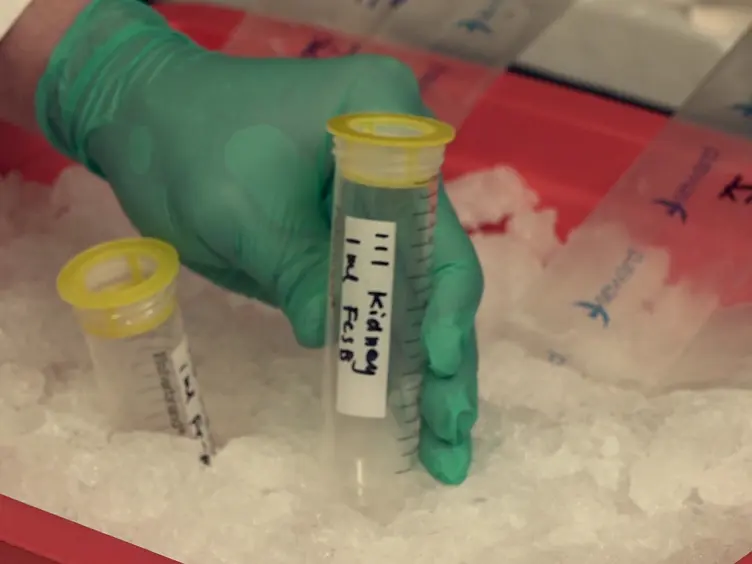 Reliable and High Efficiency Extraction of Kidney Immune Cells
